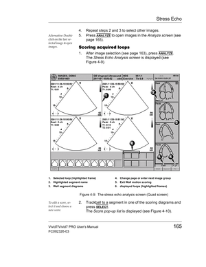 Page 179Stress Echo
Vivid7/Vivid7 PRO Users Manual165
FC092326-03
4. Repeat steps 2 and 3 to select other images.
Alternative: Double 
click on the last se-
lected image to open 
images.5. Press ANALYZE to open images in the Analyze screen (see 
page 165).
Scoring acquired loops
1. After image selection (see page 163), press ANALYZE.
The Stress Echo Analysis screen is displayed (see 
Figure 4-9).
 Figure 4-9: The stress echo analysis screen (Quad screen)
To edit a score, se-
lect it and choose a 
new score.2....