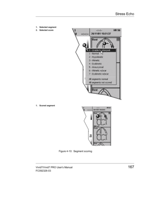 Page 181Stress Echo
Vivid7/Vivid7 PRO Users Manual167
FC092326-03
 Figure 4-10: Segment scoring
1. Selected segment
2. Selected score
1. Scored segment 