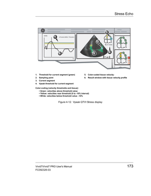 Page 187Stress Echo
Vivid7/Vivid7 PRO Users Manual173
FC092326-03
 Figure 4-12: Vpeak QTVI Stress display
1. Threshold for current segment (green)
2. Sampling point
3. Current segment
4. Vpeak threshold for current segment5. Color-coded tissue velocity:
6. Result window with tissue velocity profile
Color-coding (velocity thresholds and tissue):
• Green: velocities above threshold value
• Yellow: velocities near threshold (0 to -10% interval)
• White: velocities below threshold value - 10% 