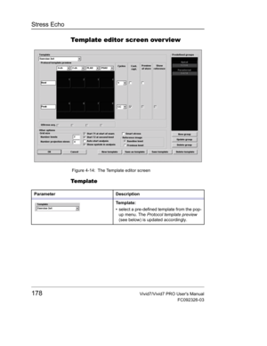 Page 192Stress Echo
178Vivid7/Vivid7 PRO Users Manual
FC092326-03
Template editor screen over view
 Figure 4-14: The Template editor screen
Te m p l at e
Parameter Description
Te m p l a t e :
•  select a pre-defined template from the pop-
up menu. The Protocol template preview 
(see below) is updated accordingly. 