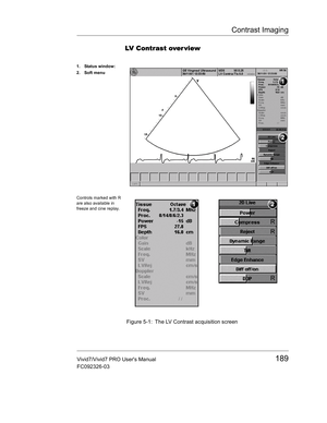 Page 203Contrast Imaging
Vivid7/Vivid7 PRO Users Manual189
FC092326-03
LV Contrast over view
 Figure 5-1: The LV Contrast acquisition screen
1. Status window:
2. Soft menu
Controls marked with R 
are also available in 
freeze and cine replay. 