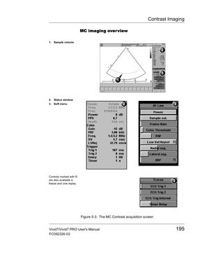 Page 209Contrast Imaging
Vivid7/Vivid7 PRO Users Manual195
FC092326-03
MC imaging over view
 Figure 5-3: The MC Contrast acquisition screen
1. Sample volume
2. Status window
3. Soft menu
Controls marked with R 
are also available in 
freeze and cine replay. 