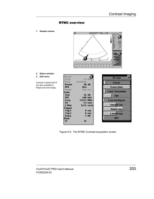 Page 217Contrast Imaging
Vivid7/Vivid7 PRO Users Manual203
FC092326-03
RTMC over view
 Figure 5-5: The RTMC Contrast acquisition screen
1. Sample volume
2. Status window:
3. Soft menu
Controls marked with R 
are also available in 
freeze and cine replay. 