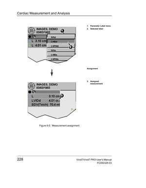 Page 242Cardiac Measurement and Analysis
228Vivid7/Vivid7 PRO Users Manual
FC092326-03
 Figure 6-5: Measurement assignment
1. Parameter Label menu
2. Selected label
Assignment
3. Assigned 
measurement 