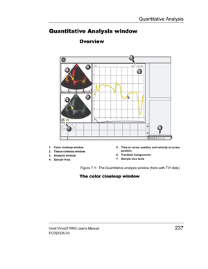 Page 251Quantitative Analysis
Vivid7/Vivid7 PRO Users Manual237
FC092326-03
Quantitative Analysis window
Over view
 Figure 7-1: The Quantitative analysis window (here with TVI data)
The color cineloop window
1. Color cineloop window
2. Tissue cineloop window
3. Analysis window
4. Sample Area5. Time at cursor position and velocity at cursor 
position
6. Trackball Assignments
7. Sample area tools
7 