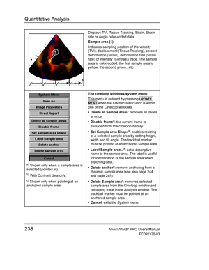 Page 252Quantitative Analysis
238Vivid7/Vivid7 PRO Users Manual
FC092326-03
Displays TVI, Tissue Tracking, Strain, Strain 
rate or Angio color-coded data.
Sample area (1):
Indicates sampling position of the velocity 
(TVI), displacement (Tissue Tracking), percent 
deformation (Strain), deformation rate (Strain 
rate) or intensity (Contrast) trace. The sample 
area is color-coded: the first sample area is 
yellow, the second green...etc.
a) Shown only when a sample area is 
selected (pointed at).
b) With Contrast...