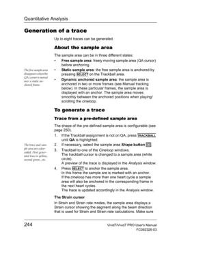 Page 258Quantitative Analysis
244Vivid7/Vivid7 PRO Users Manual
FC092326-03
Generation of a trace
Up to eight traces can be generated.
About the sample area
The sample area can be in three different states:
• Free sample area: freely moving sample area (QA cursor) 
before anchoring.
The free sample area 
disappears when the 
QA cursor is moved 
over a static an-
chored frame.• Static sample area: the free sample area is anchored by 
pressing 
SELECT on the Trackball area.
• Dynamic anchored sample area: the...