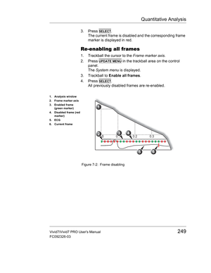 Page 263Quantitative Analysis
Vivid7/Vivid7 PRO Users Manual249
FC092326-03
3. Press SELECT.
The current frame is disabled and the corresponding frame 
marker is displayed in red.
Re-enabling all frames
1. Trackball the cursor to the Frame marker axis.
2. Press 
UPDATE MENU in the trackball area on the control 
panel.
The System menu is displayed.
3. Trackball to Enable all frames.
4. Press 
SELECT.
All previously disabled frames are re-enabled.
 Figure 7-2: Frame disabling
1. Analysis window
2. Frame marker...