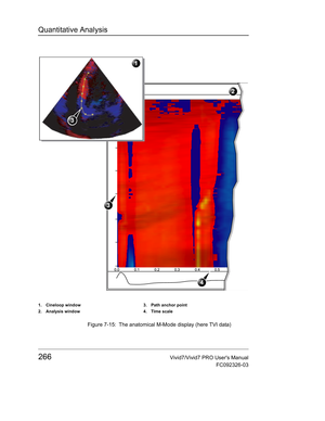 Page 280Quantitative Analysis
266Vivid7/Vivid7 PRO Users Manual
FC092326-03
 Figure 7-15: The anatomical M-Mode display (here TVI data)
1. Cineloop window
2. Analysis window3. Path anchor point
4. Time scale
2
3
4
1
3 