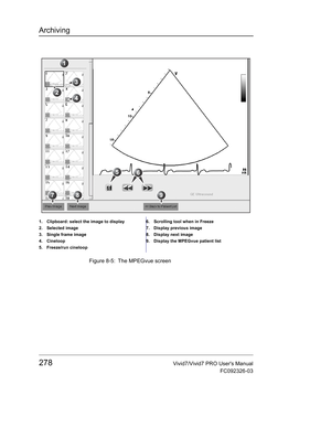 Page 292Archiving
278Vivid7/Vivid7 PRO Users Manual
FC092326-03
 Figure 8-5: The MPEGvue screen
1. Clipboard: select the image to display
2. Selected image
3. Single frame image
4. Cineloop
5. Freeze/run cineloop6. Scrolling tool when in Freeze
7. Display previous image
8. Display next image
9. Display the MPEGvue patient list 