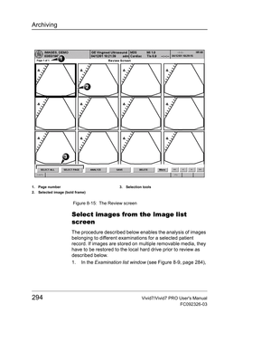 Page 308Archiving
294Vivid7/Vivid7 PRO Users Manual
FC092326-03
 Figure 8-15: The Review screen
Select images from the Image list 
screen
The procedure described below enables the analysis of images 
belonging to different examinations for a selected patient 
record. If images are stored on multiple removable media, they 
have to be restored to the local hard drive prior to review as 
described below.
1. In the Examination list window (see Figure 8-9, page 284), 
1. Page number
2. Selected image (bold frame)3....