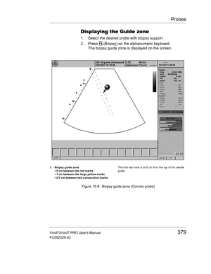 Page 393Probes
Vivid7/Vivid7 PRO Users Manual379
FC092326-03
Displaying the Guide zone
1. Select the desired probe with biopsy support.
2. Press 
F5 (Biopsy) on the alphanumeric keyboard.
The biopsy guide zone is displayed on the screen.
 Figure 10-8: Biopsy guide zone (Convex probe)
1. Biopsy guide zone
• 5 cm between the red marks
• 1 cm between the large yellow marks
• 0.5 cm between two consecutive marksThe first red mark is at 5 cm from the top of the needle 
guide. 