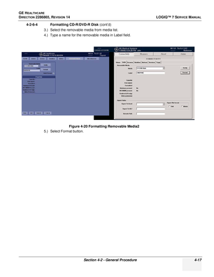 Page 101GE HEALTHCARE
DIRECTION 2286865, REVISION 14LOGIQ™ 7 SERVICE MANUAL
Section 4-2 - General Procedure 4-17
4-2-6-4 Formatting CD-R/DVD-R Disk (cont’d)
3.) Select the removable media from media list.
4.) Type a name for the removable media in Label field.
5.) Select Format button. Figure 4-20 Formatting Removable Media2 