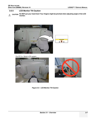 Page 65GE HEALTHCARE
DIRECTION 2286865, REVISION 14LOGIQ™ 7 SERVICE MANUAL
Section 3-1 - Overview 3-7
3-2-3 LCD Monitor Tilt Caution
CAUTIONDo NOT put your hand here! Your fingers might be pinched when adjusting angle of the LCD 
monitor.
Figure 3-3   LCD Monitor Tilt Caution
For R7.5.x 19inch LCD system 