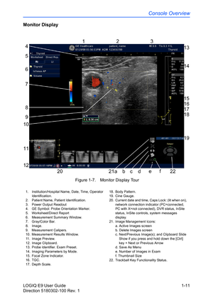 Page 21Console Overview
LOGIQ E9 User Guide 1-11
Direction 5180302-100 Rev. 1
Monitor Display
 Figure 1-7. Monitor Display Tour
1.  Institution/Hospital Name, Date, Time, Operator 
Identification.
2.  Patient Name, Patient Identification.
3. Power Output Readout
4.  GE Symbol: Probe Orientation Marker.
5. Worksheet/Direct Report 
6. Measurement Summary Window.
7. Gray/Color Bar.
8. Image.
9. Measurement Calipers.
10. Measurement Results Window. 
11. Image Preview.
12. Image Clipboard.
13.  Probe Identifier....