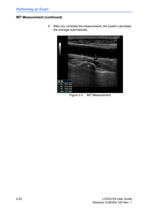 Page 66Performing an Exam
2-22 LOGIQ E9 User Guide
Direction 5180302-100 Rev. 1
IMT Measurement (continued)
6.  After you complete the measurement, the system calculates 
the average automatically. 
Figure 2-3. IMT Measurement 