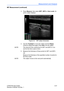 Page 65Measurement and Analysis
LOGIQ E9 User Guide 2-21
Direction 5180302-100 Rev. 1
IMT Measurement (continued)
3. Press Measure, then select IMT1, IMT2 or 5mm scale. An 
active caliper displays. 
Figure 2-2. IMT caliper (Example)
4. Use the Trackball to move the caliper and the Ellipse 
control to adjust the angle. Press Set to fix the caliper. 
NOTE:  The interval of the vertical line for IMT1 and IMT2 is 1cm 
and for the 5mm scale is 5mm. 
5.  Measure the thickness of three points for IMT1 and IMT2.
OR...