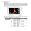 Page 200
00  Camera and Multimedia

ZoomingBefore capturing a photo or a video clip, you can zoom in or out on your subject. To zoom in or out, slide your finger up or down on the Zoom bar while holding the device sideways. While you are sliding your finger on the Zoom bar, the level of zoom is shown on the zoom control bar on the screen.
Zoom control barZoom bar
The camera zoom range for a photo or a video clip depends on the capture mode and resolution. Refer to the table for more information.
Capture...