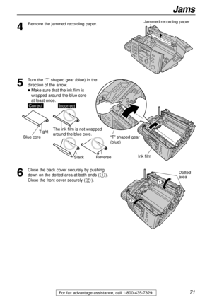 Page 7171
Jams
For fax advantage assistance, call 1-800-435-7329.
4
Remove the jammed recording paper.Jammed recording paper
Ink film
“T” shaped gear 
(blue)
5
Turn the “T” shaped gear (blue) in the
direction of the arrow. 
lMake sure that the ink film is 
wrapped around the blue core 
at least once.
SlackReverse
Tight
CorrectIncorrect
Blue core
The ink film is not wrapped 
around the blue core.
6
Close the back cover securely by pushing
down on the dotted area at both ends ().
Close the front cover securely...