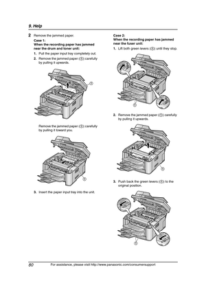 Page 829. Help
80
For assistance, please visit http://www.panasonic.com/consumersupport
2Remove the jammed paper.
Case 1:
When the recording paper has jammed 
near the drum and toner unit:
1.Pull the paper input tray completely out.
2.Remove the jammed paper (1) carefully 
by pulling it upwards.
Remove the jammed paper (1) carefully 
by pulling it toward you.
3.Insert the paper input tray into the unit.Case 2:
When the recording paper has jammed 
near the fuser unit:
1.Lift both green levers (1) until they...