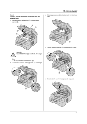 Page 7712. Atascos de papel
77
Caso 3:
Cuando el papel de impresión se ha atascado cerca de la 
unidad del fusor:
1.
Levante la palanca de liberación (1) y abra la cubierta 
superior (
2).
Nota:
LNo toque el rodillo de transferencia (4).
2.Levante ambas palancas verdes (5) hasta que se detengan.
3.Retire el papel atascado (6) cuidadosamente tirándolo hacia 
arriba.
4.Presione las palancas verdes (7) hasta la posición original.
5.Cierre la cubier ta superior hasta que quede asegurada.
Atención:
La unidad del...